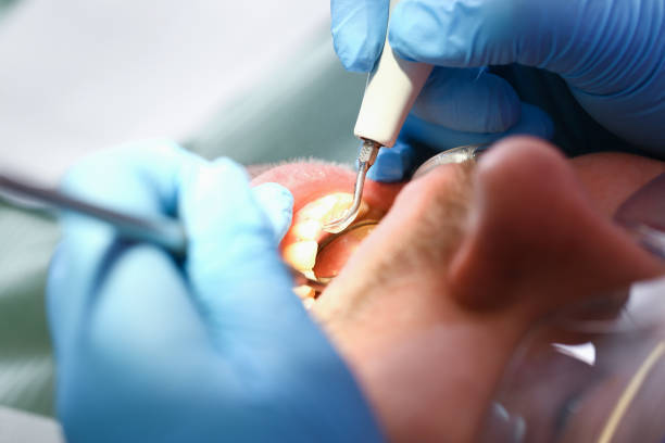 Best Broken Tooth Emergency  in Woodland Park, NE